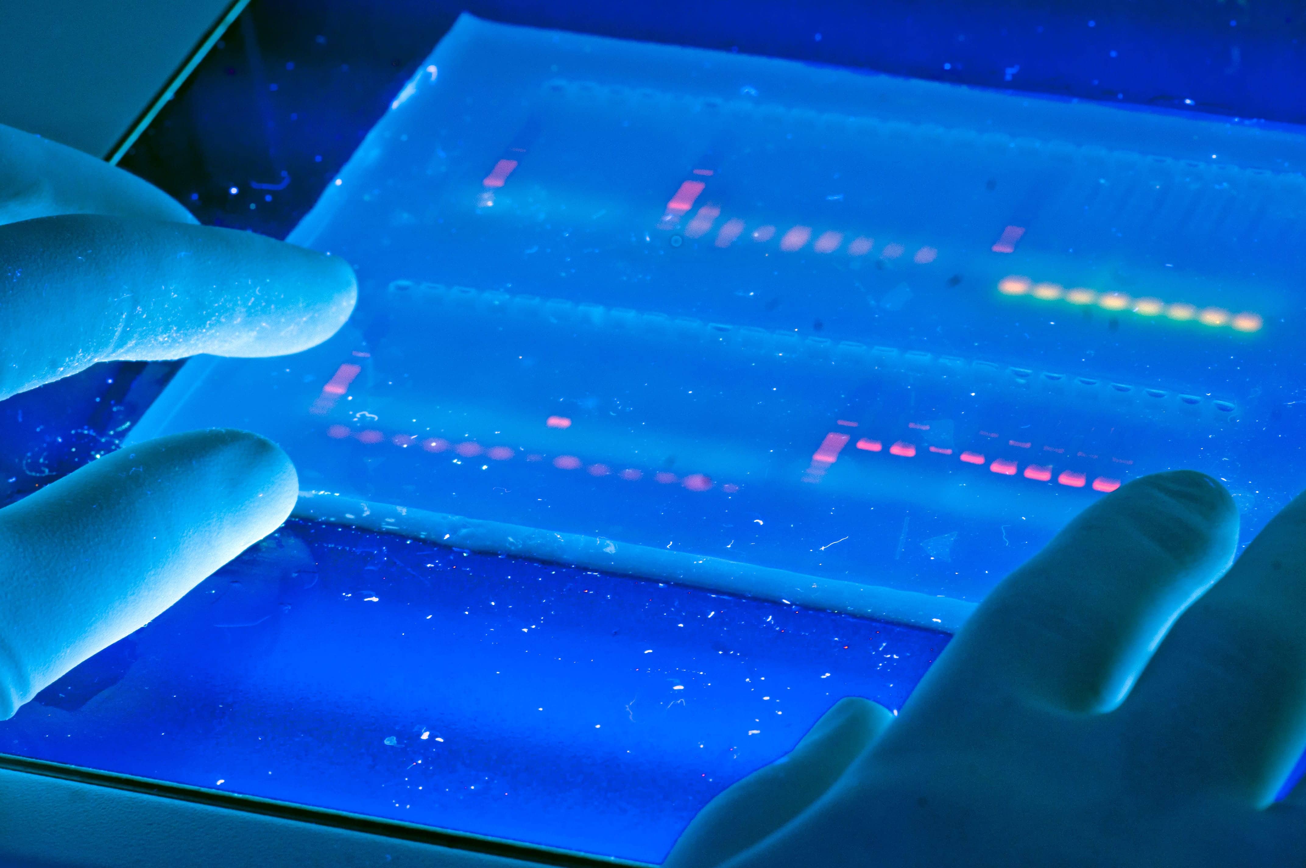Hydrogel microfluidic chip for microfluidics