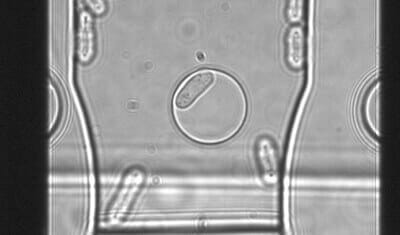 pyright microfluidic cgannel with pombe yeast cell.jpg