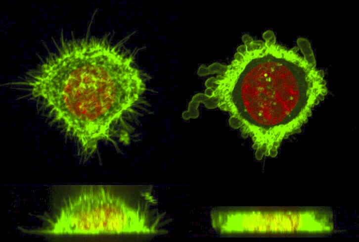 HeLa cell deformation using microfluidic device