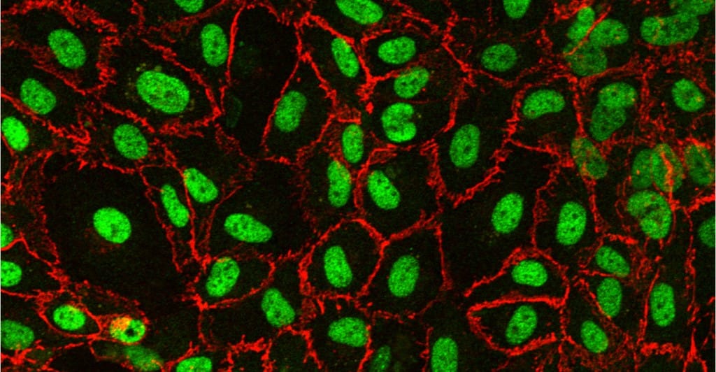 Endothelial cell culture laminar flow perfusion