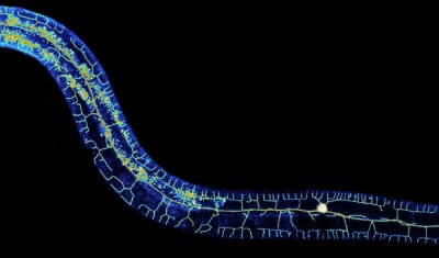 C-elegans-immobilization-live-cell-imaging-microfluidic