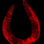 C_elegans_stained