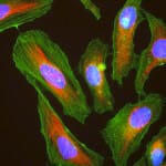 HeLa_cells_stained_with_antibody_to_actin_(green)_,_vimentin_(red)_and_DNA_(blue)