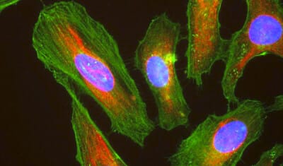 HeLa_cells_stained_with_antibody_to_actin_(green)_,_vimentin_(red)_and_DNA_(blue)