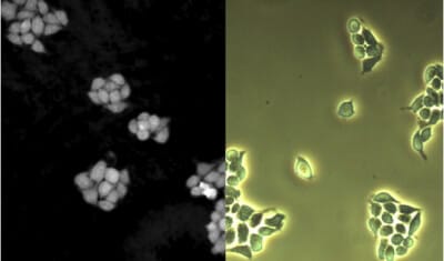 Microfluidic cell culture