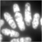 Schizosaccharomyces_pombe_DHE