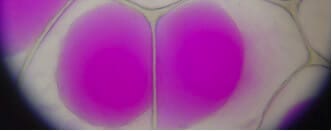 Microfluidics for DNA analysis_Chemical Cell Lysis