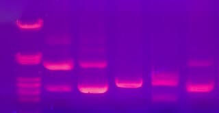 Microfluidics for DNA analysis_DNA Electrophoresis