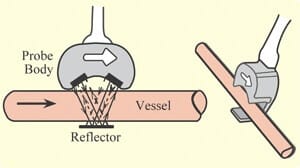 Ultrasonic-liquid flow meter