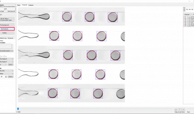 Microfluidic droplet generation flow focusing analysis background threshold