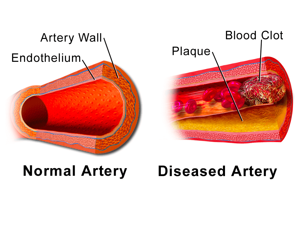 Lungonchip Schema of blood clot Elveflow