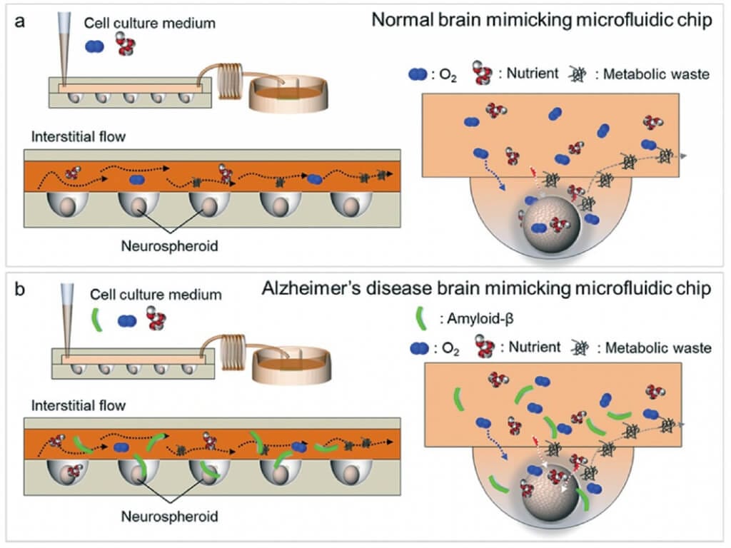 brain-on-chip Figure 3: From Park, J., Lee, B. K., Jeong, G. S., Hyun, J. K., Lee, C. J., & Lee, S. H. (2015). Schematic representation of both a normal brain mimicking microfluidic chip (a) and an Alzheimer’s disease brain mimicking microfluidic chip (b). (a) In normal conditions, the neurospheroids were cultured for 10 days with oxygen and nutrients. (b) In Alzheimer’s disease conditions, cells were cultured only 7 days with oxygen and nutrients and then with a medium containing amyloid-β for 3 days.