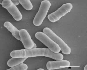 Temperature control microtubule fission yeast 31