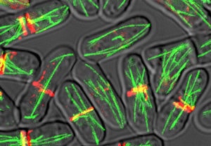 Temperature-sensitive-mutant-Fission yeast live cell imaging cell division