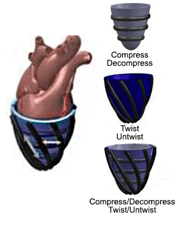 heart-prosthetic-wearable-soft-robot-robotics-softbot-softrobot-microfluidics-pressure-control
