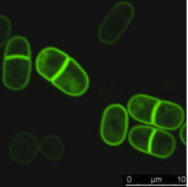 Temperature control cytokinesis fission yeast