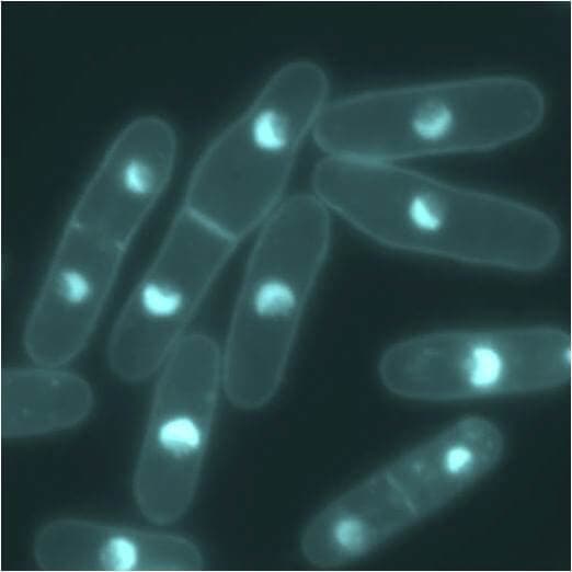 temperature control microtubule fission yeast2