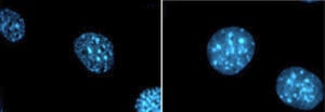 Osmotic stress on cell perfusion 1 e1573146079257