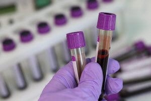 Coronavirus-laboratory test