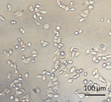 Automated cell seeding MFC7 cells in chip t4