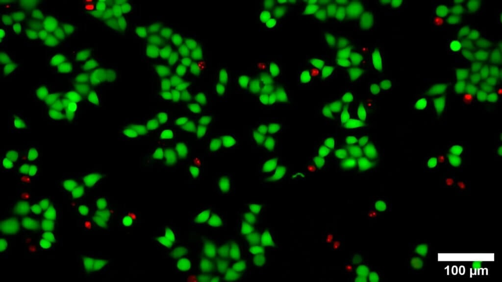How to stain cells cultured in a microfluidic chip? - Elveflow