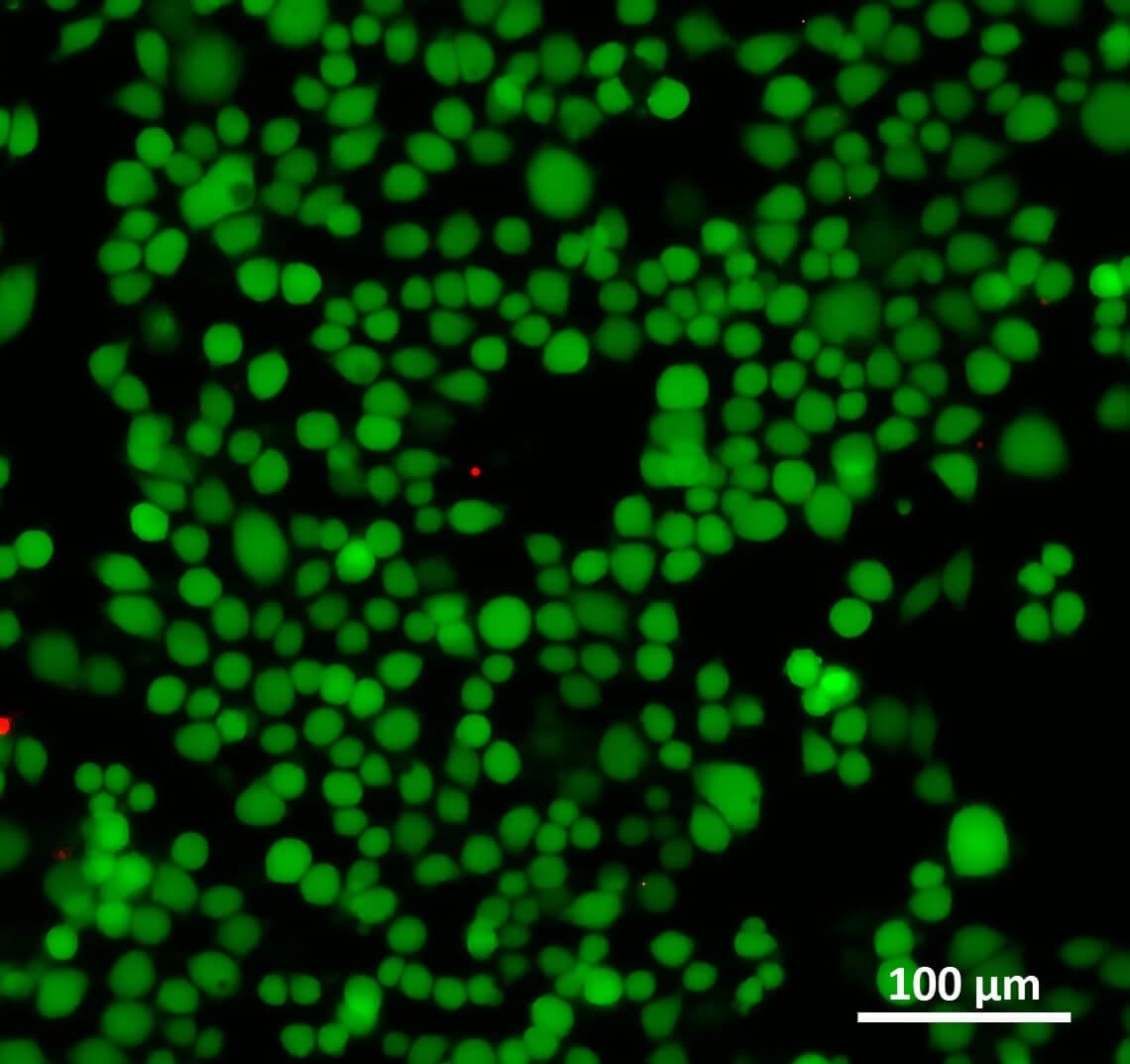 Recirculation using microfluidic valves Elveflow dynamic cell culture 1