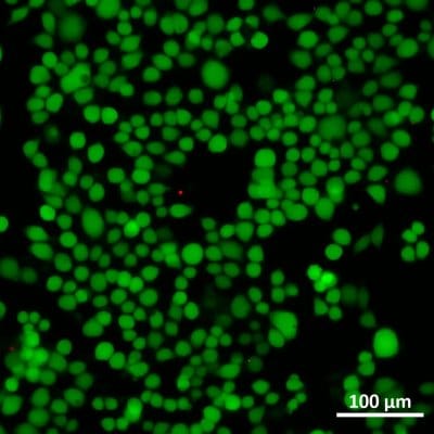 Recirculation using microfluidic valves Elveflow dynamic cell culture 2