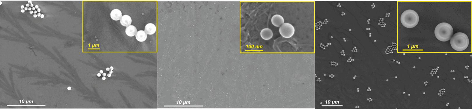 Microfluidic bacteria separation  Fig 4