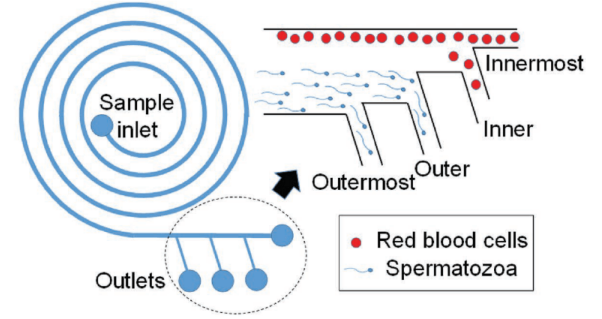 Microfluidic spiral sorting for sperm sorting