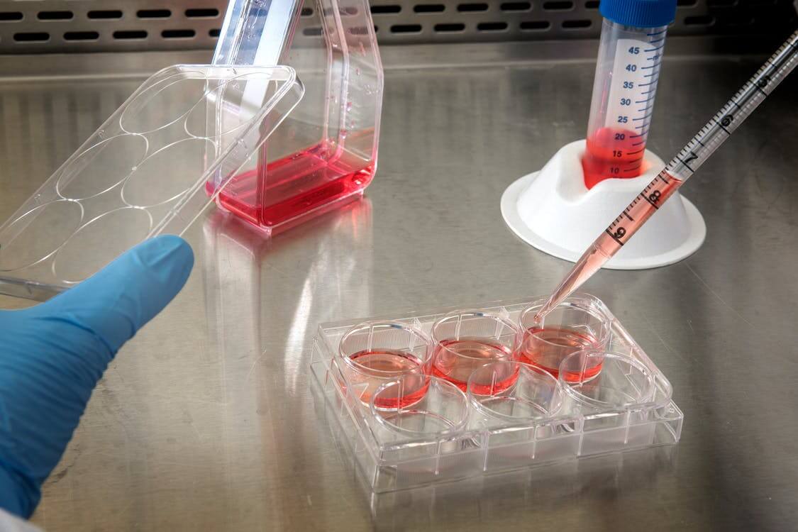 Microfluidic cell culture 3